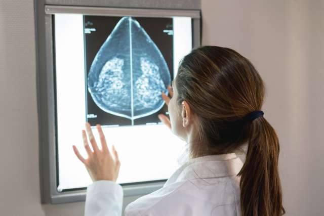 A doctor looks at a mammogram.