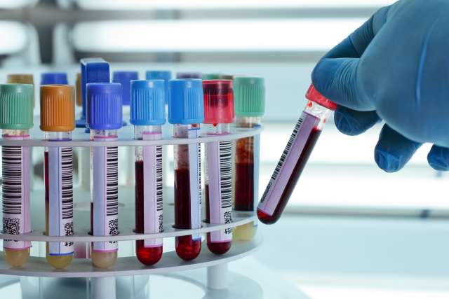 technician placing blood tubes in the laboratory centrifuge.