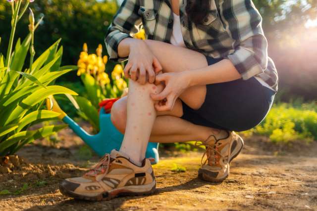 A woman scratches mosquito bites on her leg