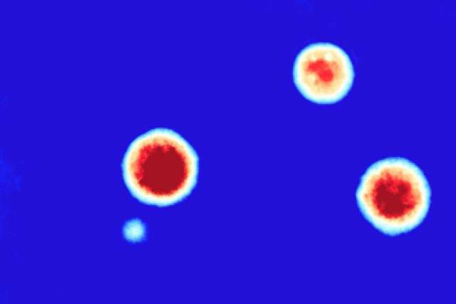 organoids 