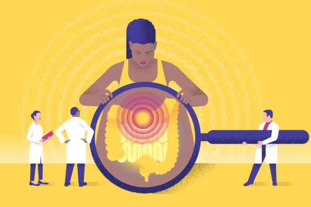 Illustration on yellow: A patient holds a magnifying glass over her abdomen, highlighting her painful intestines, with two doctors observing.