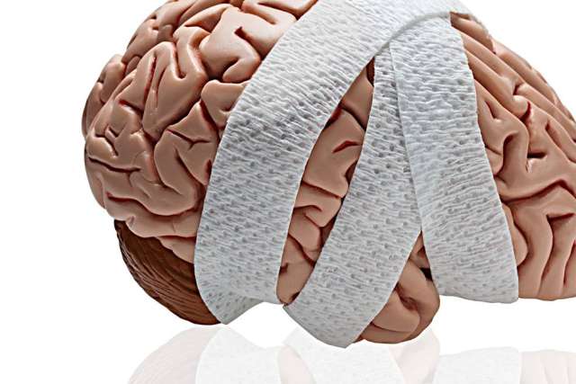 Model brain wrapped in white medical bandage