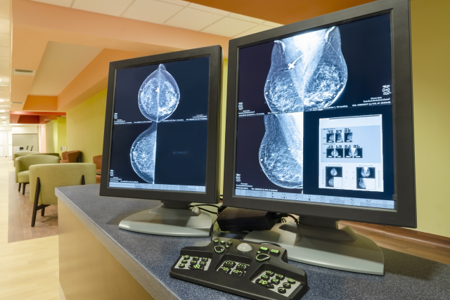Breast scans on computer screens.
