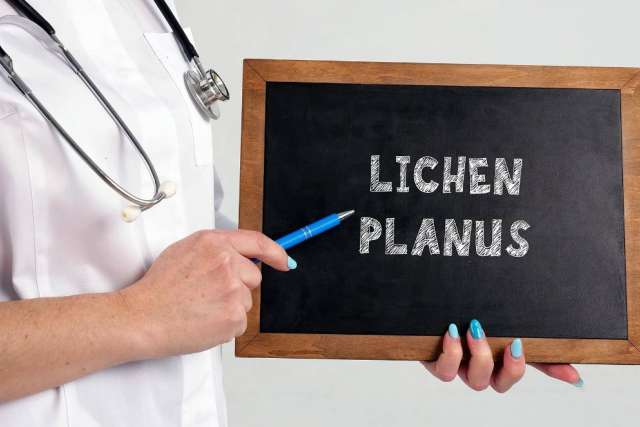 Lichen Planus written on small chalkboard held by a clinician with stethoscope.