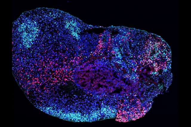 Microscopy image of a human stem cell-derived hippocampal organoid. 