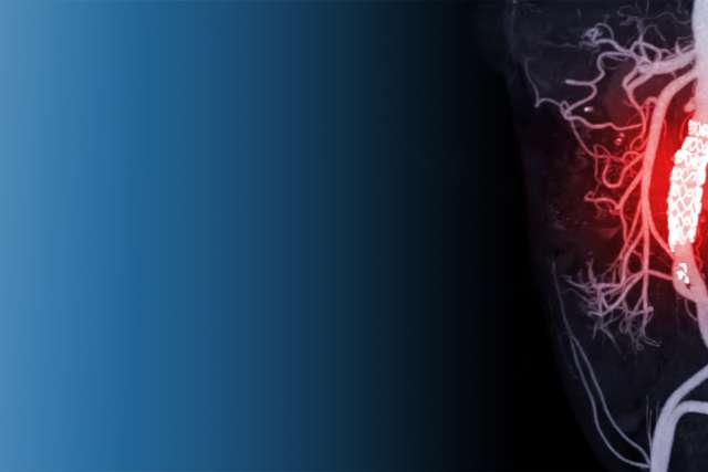 Aortic valve