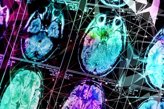 Brain scans