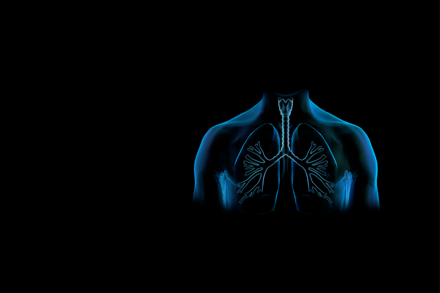 X Ray