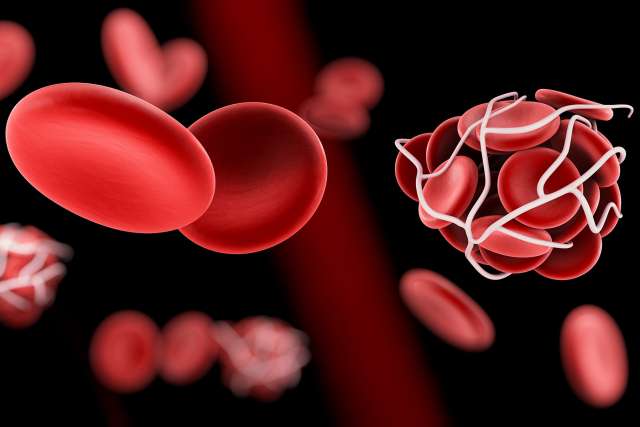 Blood clot illustration