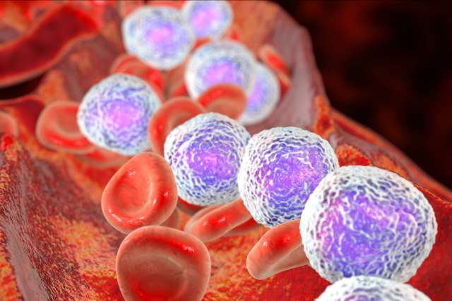Acute lymphoblastic leukemia, 3D illustration