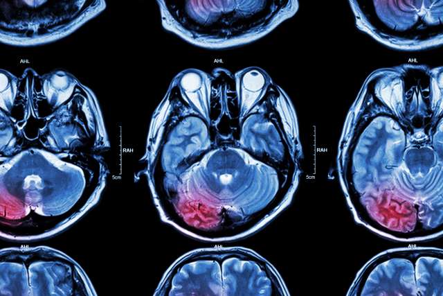 Cross section of brain 