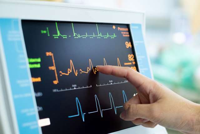 EKG machine