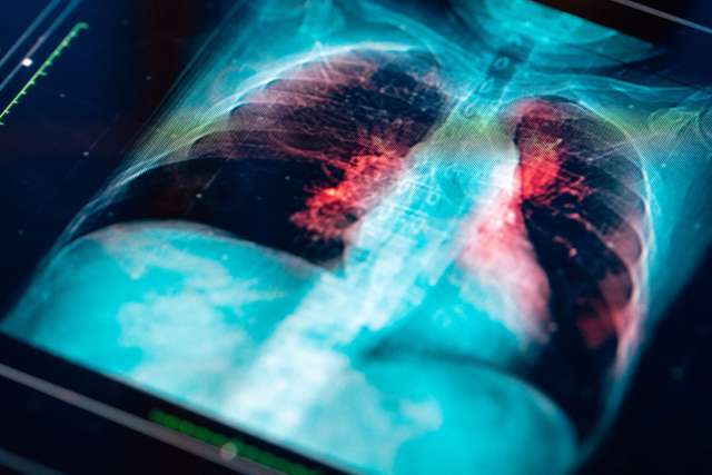 Medical MRI Scan on digital screen