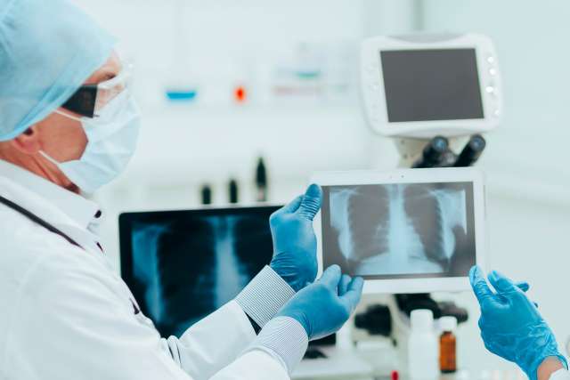 Pulmonary doctors reviewing lung X-ray