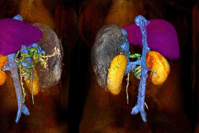 Q3D Imaging