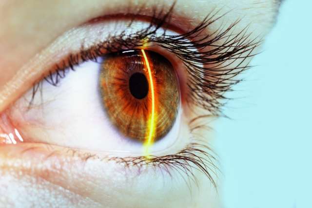 eye exam
