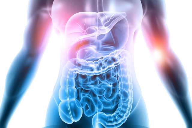 Scan of a patient with Irritable Bowel Syndrome (IBS)