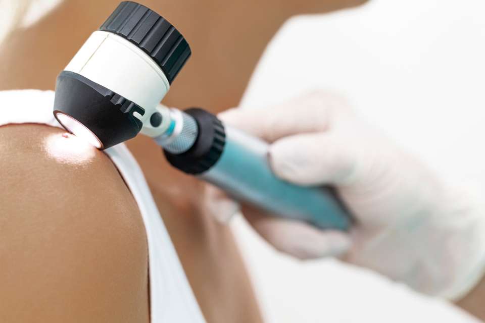 Dermatology