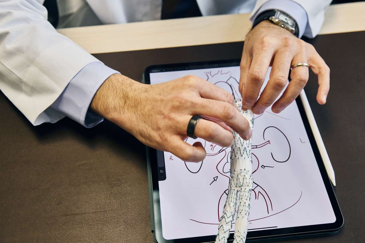 Dr. Bernardo Mendes and a stent graft.