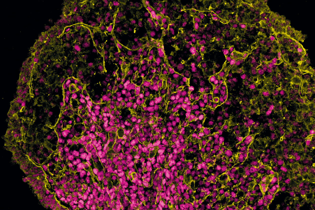 A fluorescent microscopic image reveals the intricate cellular structure of a developing human ovary, with clusters of pink cells interwoven with a network of yellow filaments against a dark background.