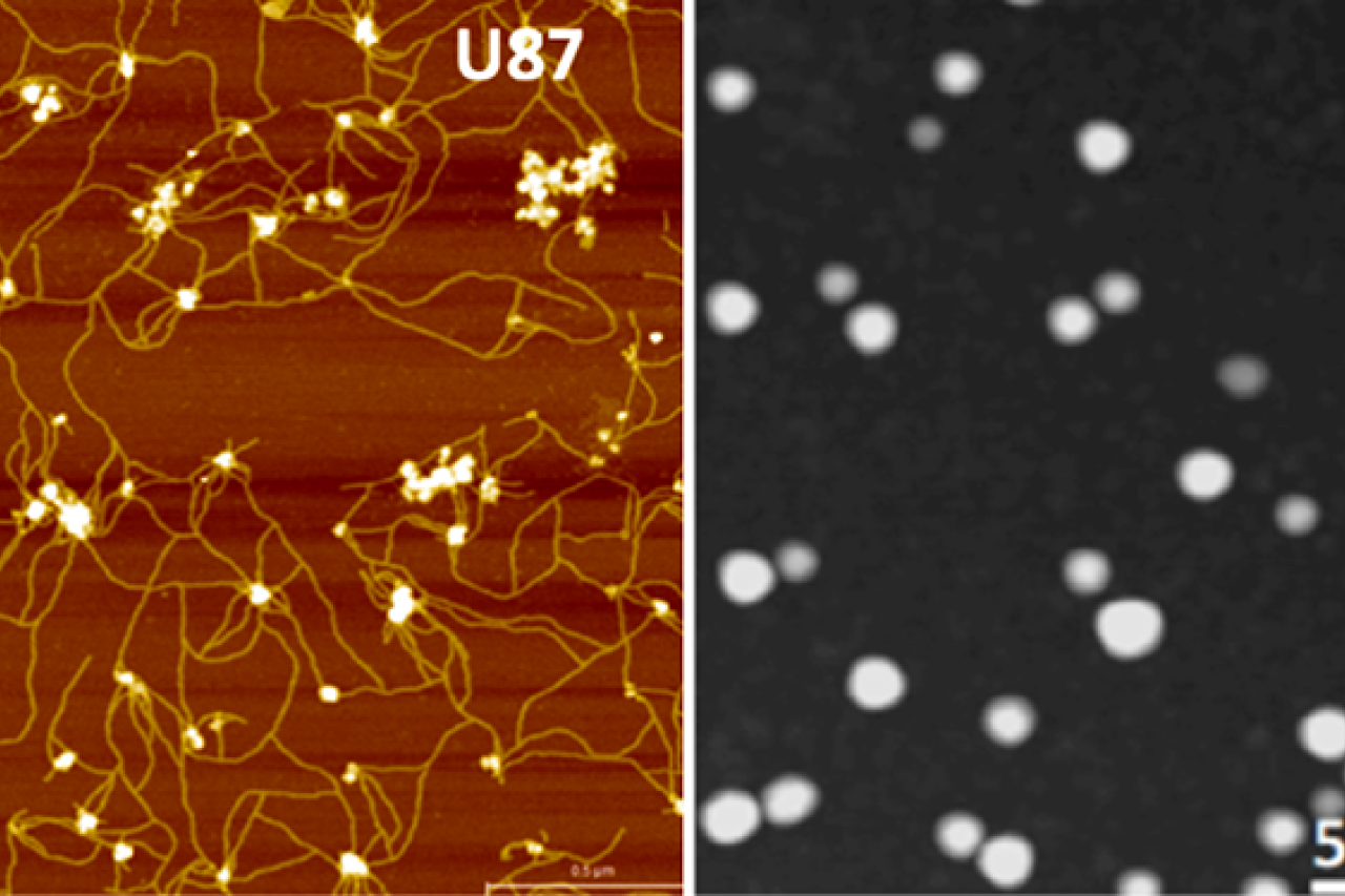 Extracellular vesicles in GBM U87 cells