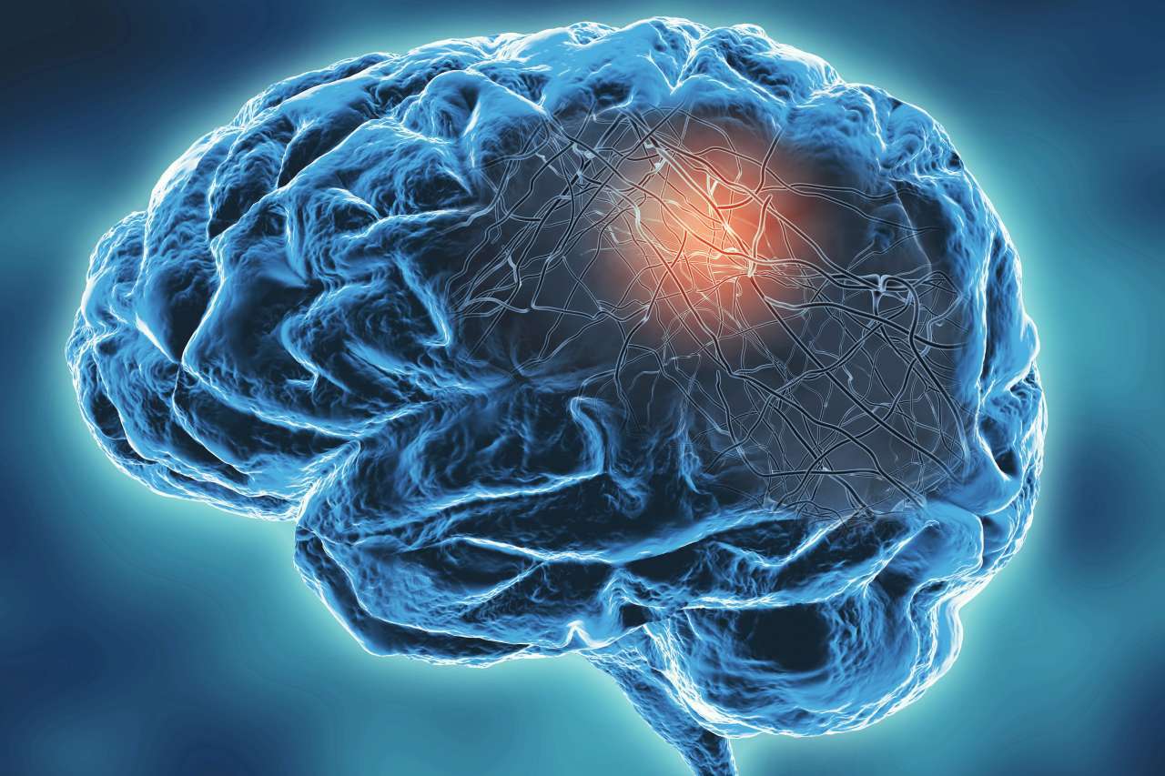 Brain imaging
