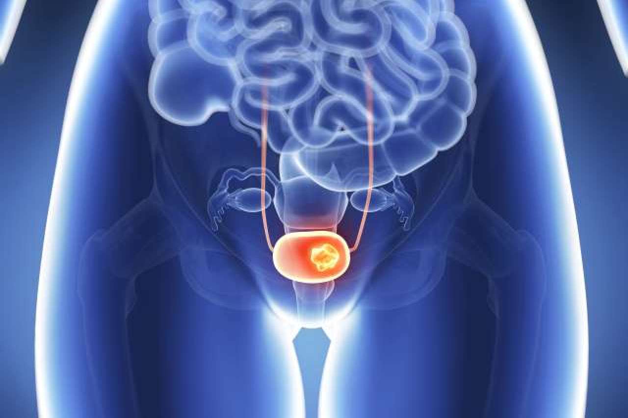 bladder cancer drug
