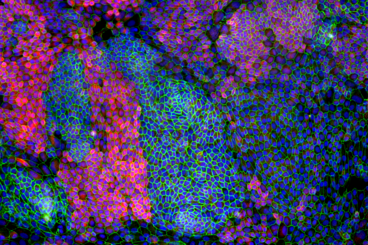A colorful microscopy image of a retinal pigment epithelium derived from an induced-pluripotent stem cell line.