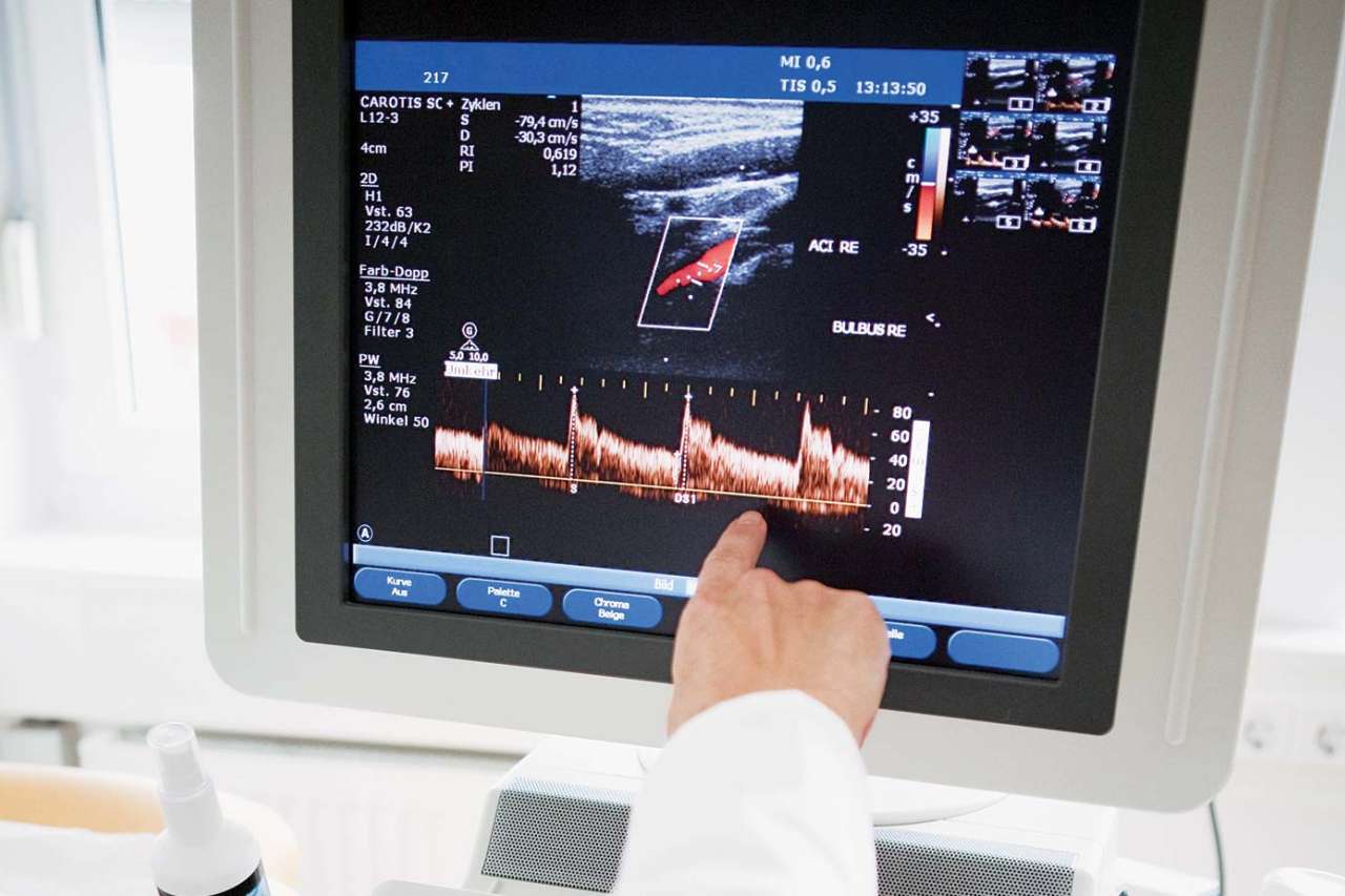 Hand pointing at monitor