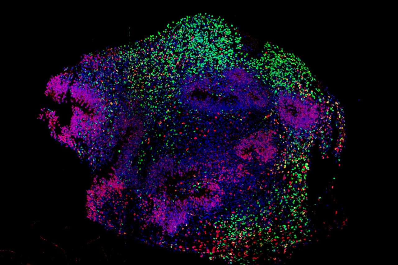 Representative image of a developing human cortex-like organoid. 