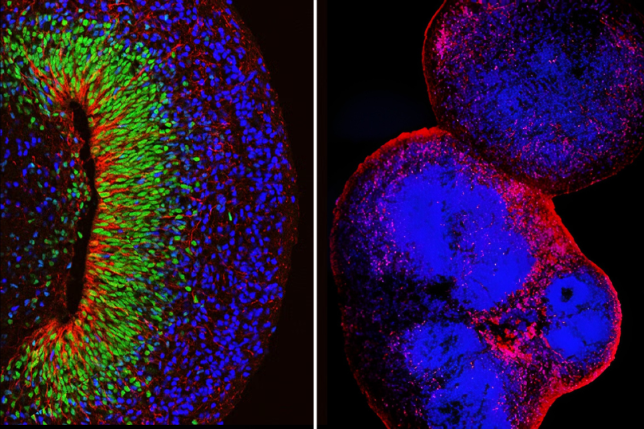 Fluorescence microscopy image of a human stem cell-derived brain organoid (left) and assembloid (right) used in neuroscience research
