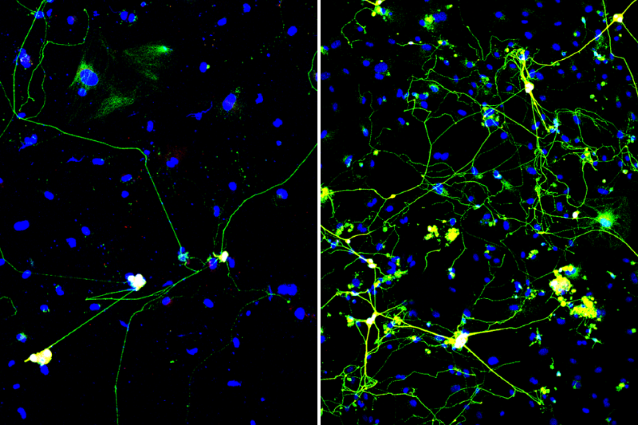 Two fluorescence microscopy panels of cells with blue nuclei and green neuron-like cells. The left panel shows only a few sparse neurons with long, thin projections, while the right panel shows many more neurons with dense, branching networks.