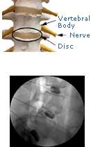 Discography illustration