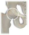 Hip Arthrogram