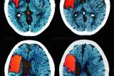 Brain Scan