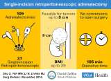Single-incision retroperitoneoscopic adrenalectomy