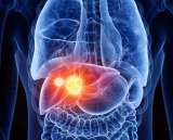 UCLA Liver Hour Series: Peri-Transplant Management of Hepatitis B cover image