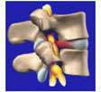 Image of a spine