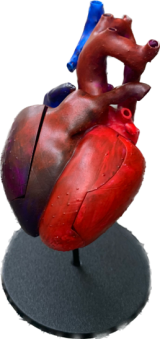 3D heart model reconstructed from ferumoxytol
