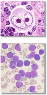 hematology