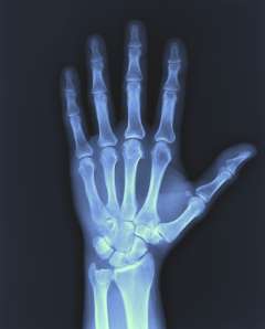 Xray of hand