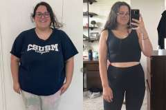 Joanna's Story - Before and After Roux-en-Y Gastric Bypass Surgery