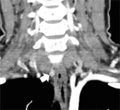 4D-CT Scan