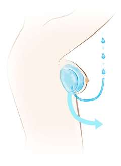 Diagram of tissue expansion