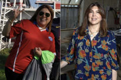 Side-by-side photos show a woman before and after weight loss following gastric sleeve surgery.