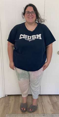 Joanna's Story - Before Roux-en-Y Gastric Bypass Surgery