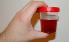 urine sample