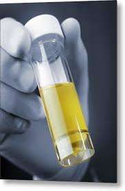 urine sample