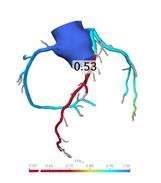 FFR Fig 1