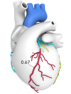 FFR Fig 3